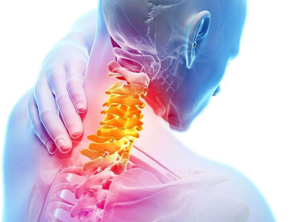ជំងឺ osteochondrosis មាត់ស្បូន