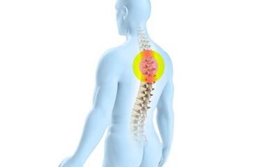 osteochondrosis នៃឆ្អឹងខ្នង thoracic